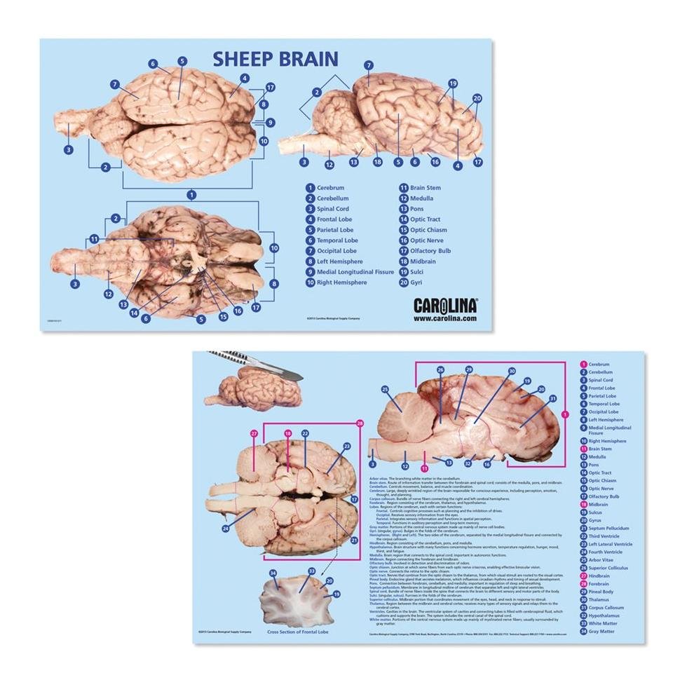 Carolina Dissektionsmatta – Hjärna